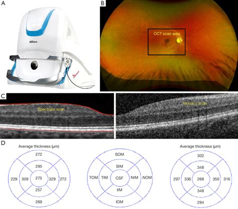 Optos Monaco fundus photography and optical coherence tomography (OCT ...