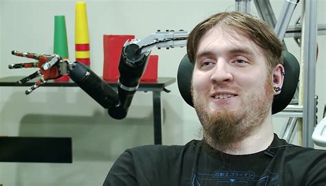 Man with brain implant on Musk’s Neuralink: “I would play video games” | MIT Technology Review