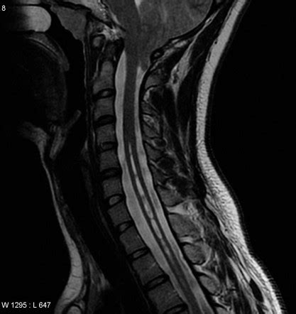 Radiology Quiz 4977 | Radiopaedia.org