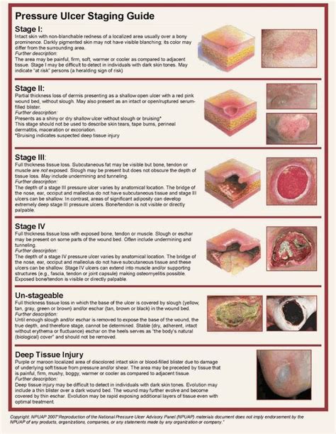 Pressure ulcer stages | Pressure ulcer staging, Pressure ulcer, Home ...