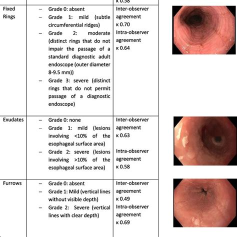 High-quality endoscopy in eosinophilic esophagitis | Download ...