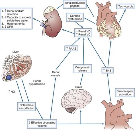 Types Of Hepatorenal Syndrome