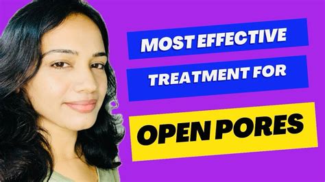 தமிழில் - Effective Skincare Routine for Open Pores in Tamil | How to treat Open Pores ...