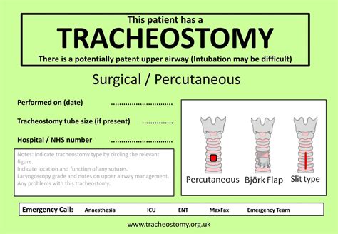 Tracheostomy Overview | Procedure | Types | Emergencies | Geeky Medics