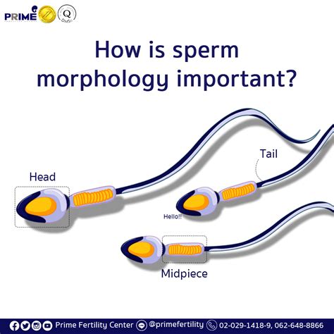 How is sperm morphology important? Thailand Fertility Clinic|IVF/ICSI