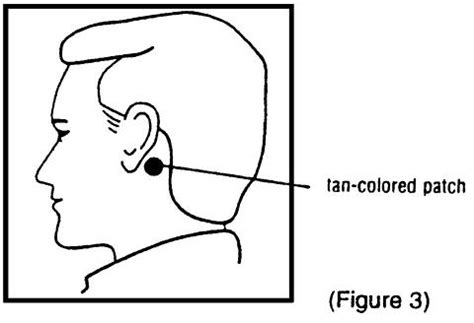 Trans Scopolamine Patch - piratebaymedia