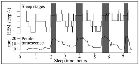 Penile tumescence during the different stages of sleep. Nocturnal... | Download Scientific Diagram