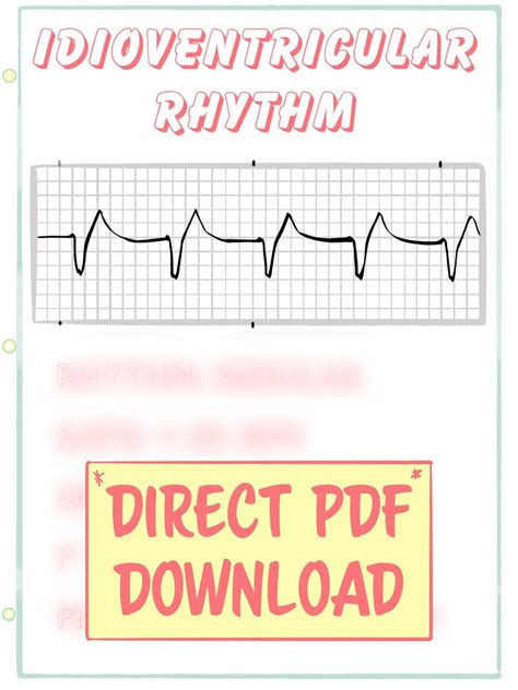 Idioventricular Rhythm ECG Guide: PDF Study Guide - Etsy