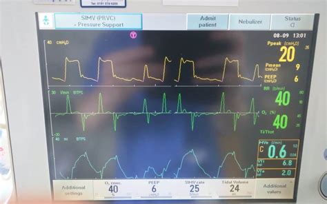 Setting up the Ventilator | Paediatric Emergencies