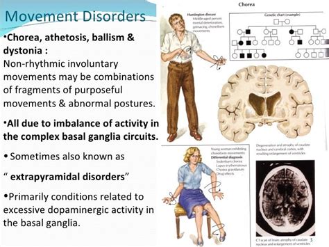 Movement disorders lecture