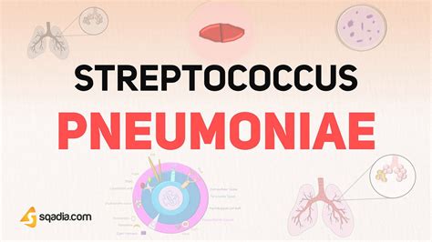 Streptococcus Pneumoniae