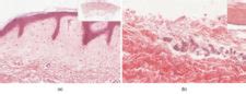 Structure and Function of Skin | Biology for Majors II