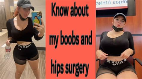 Know about my plastic surgery by Amanda Nicole - YouTube