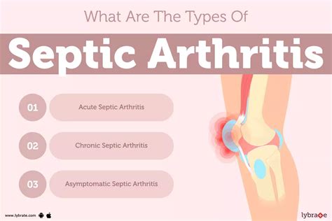 Septic Arthritis: Causes, Symptoms, Treatment and Cost