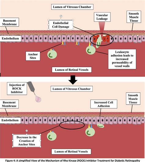 [PDF] Use of Rho kinase Inhibitors in Ophthalmology: A Review of the ...