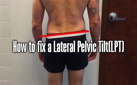 How to fix a Lateral Pelvic Tilt(LPT) - Your Body Posture