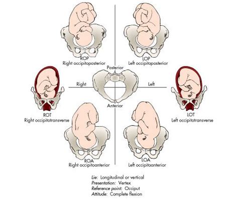 14 best images about presentation and lie of baby on Pinterest | Labor, Track records and To tell