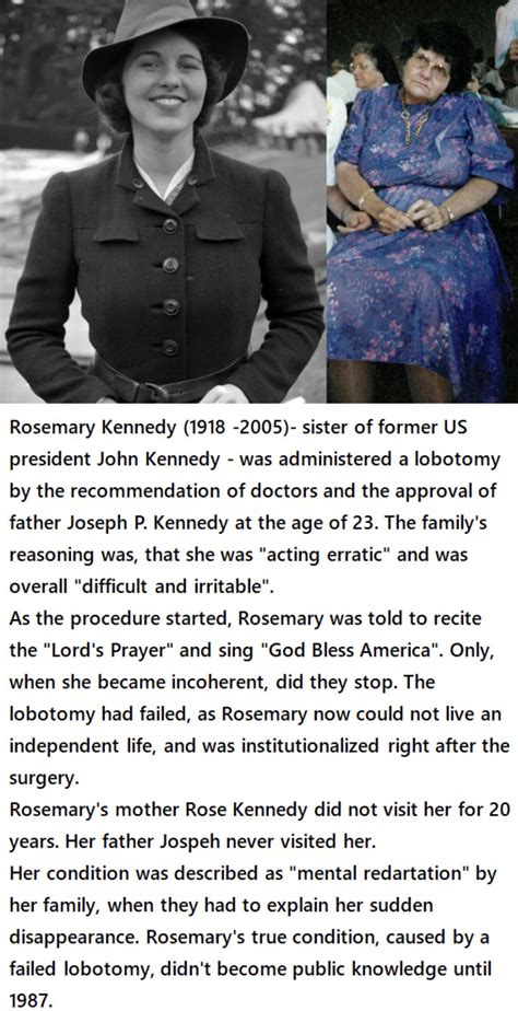 Rosemary Kennedy and lobotomy : r/TerrifyingAsFuck