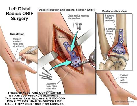 Medical Exhibits, Demonstrative Aids, Illustrations and Models