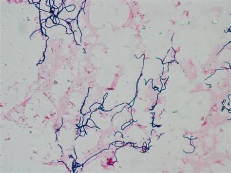 Streptococcus mitis · iNaturalist