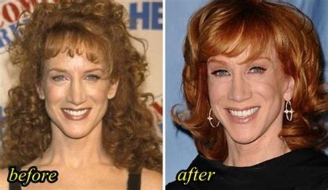 Kathy Griffin plastic surgery (20) – Celebrity plastic surgery online