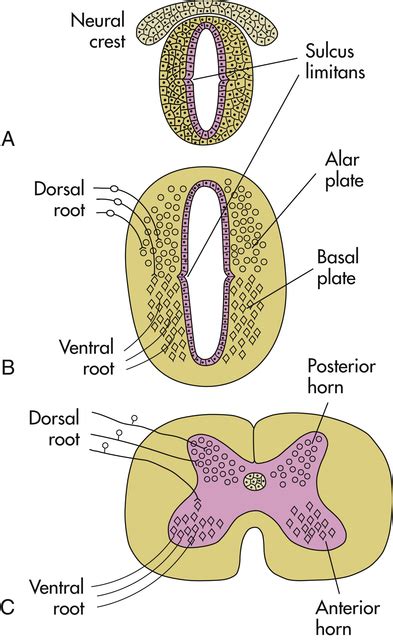 Alterations of Neurologic Function in Children | Basicmedical Key