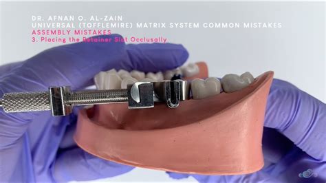 Universal (Tofflemire) matrix system (3) common mistakes during assembly and application-Arabic ...