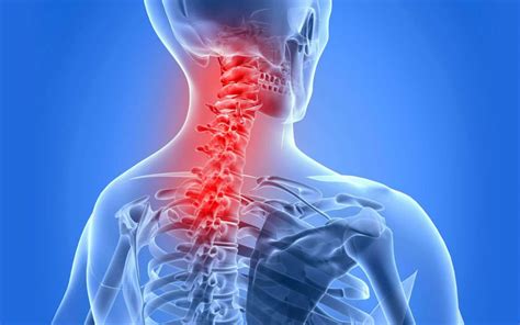 Ankylosing Spondylitis - Qualmedica Research