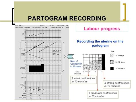 Partogram