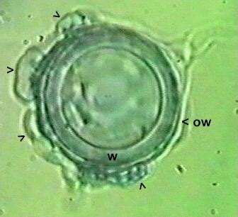 Oligandrum pythium – Sazenice zahrada