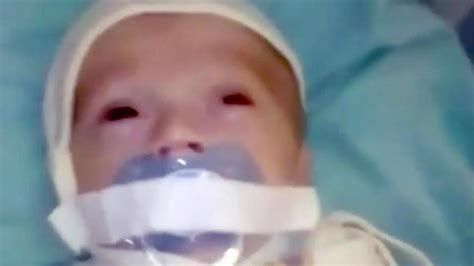 Baby in Russian hospital had mouth covered with sticky tape | Video | Herald Sun