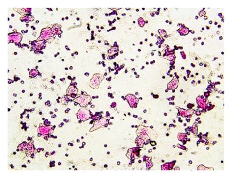 Mice typical vaginal smear of different stages of the oestrous cycle... | Download Scientific ...