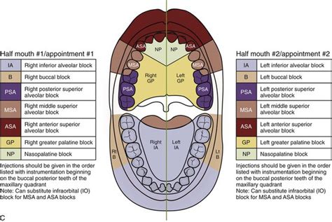 11: Basic Injection Techniques | Pocket Dentistry