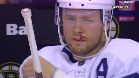 Morgan Rielly hit in the face by a Chara shot : r/hockey