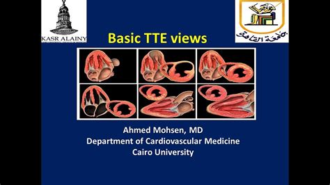 Basic Transthoracic Echocardiography (TTE) views - YouTube