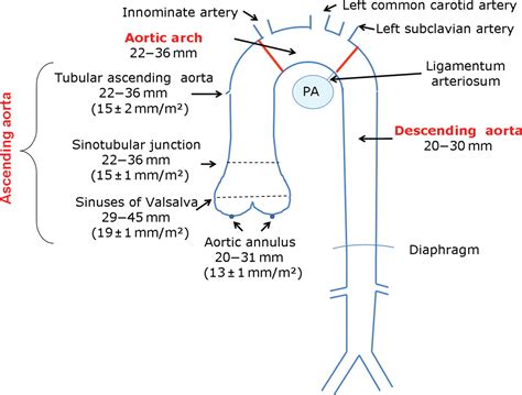 EchoTalk blog agora é echotalkblog.com: Aorta by European "DIC"