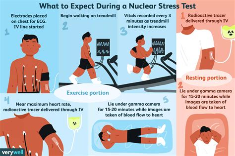 What Is a Nuclear Stress Test? - THW Cardiology Center in Maple