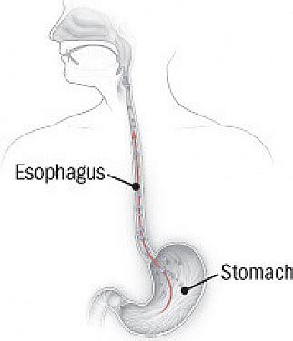 What Causes Belching