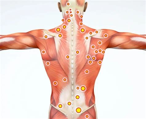 Les muscles de la colonne vertébrale: un guide complet | Clinique du dos