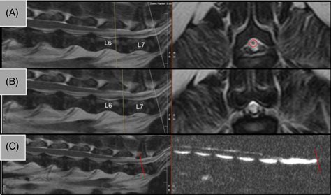 Morphometric analysis of spinal cord termination in Cavalier King ...