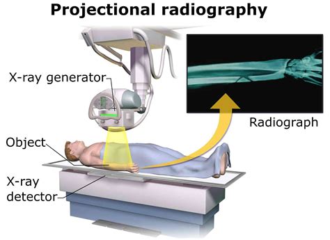 Curious Kids: Is x-ray vision possible?