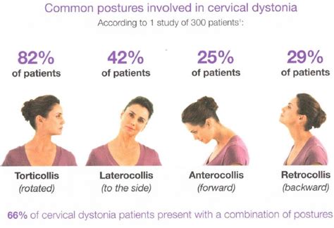 Comprehensive Pain Management by Judy Lee M.D., Ph.D (Pain Specialist) - botox-injection-for ...