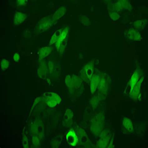 Green Fluorescent HepG2 Cell Line - Innoprot Stable Cell Lines