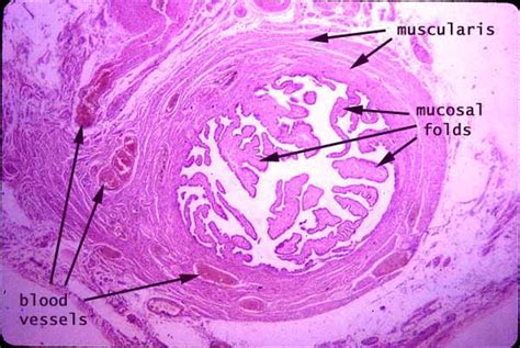 normal fallopian tube histology