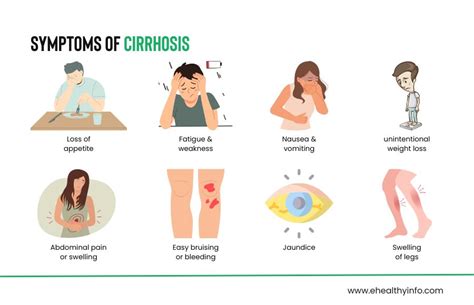 Liver Cirrhosis: Symptoms , Treatments, Causes And Misconceptions