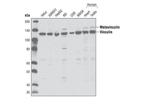 Vinculin Antibody | Cell Signaling Technology