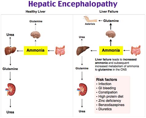 Hepatic Encephalopathy Patient