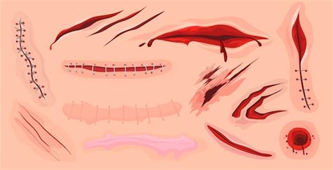 Free Vector | Human skin scars, cuts and bloody wounds flat set