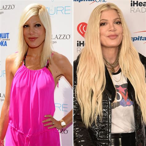 Tori Spelling Plastic Surgery Transformation: Before, After Photos ...