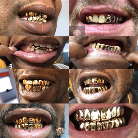 10K GOLD GRILLZ | SmirkGoldGrillz